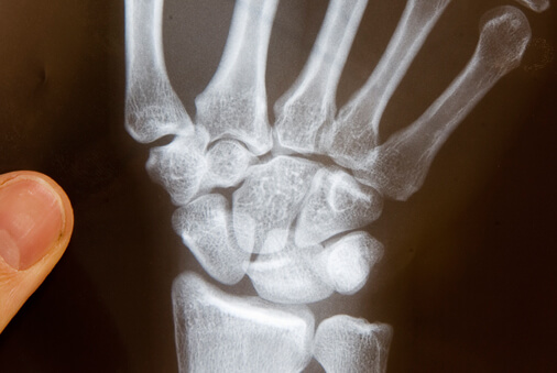 Handrehabilitation / Chirurgie