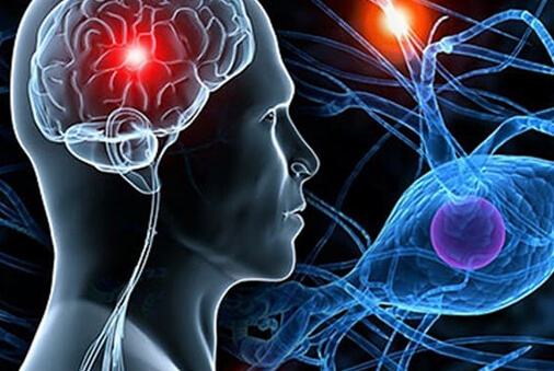 Neurologie