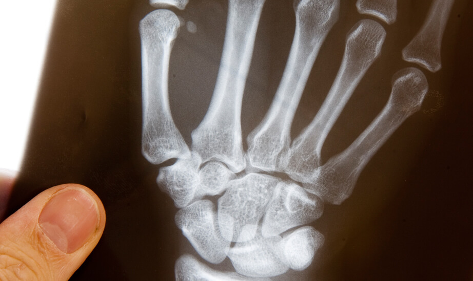 Handrehabilitation / Chirurgie